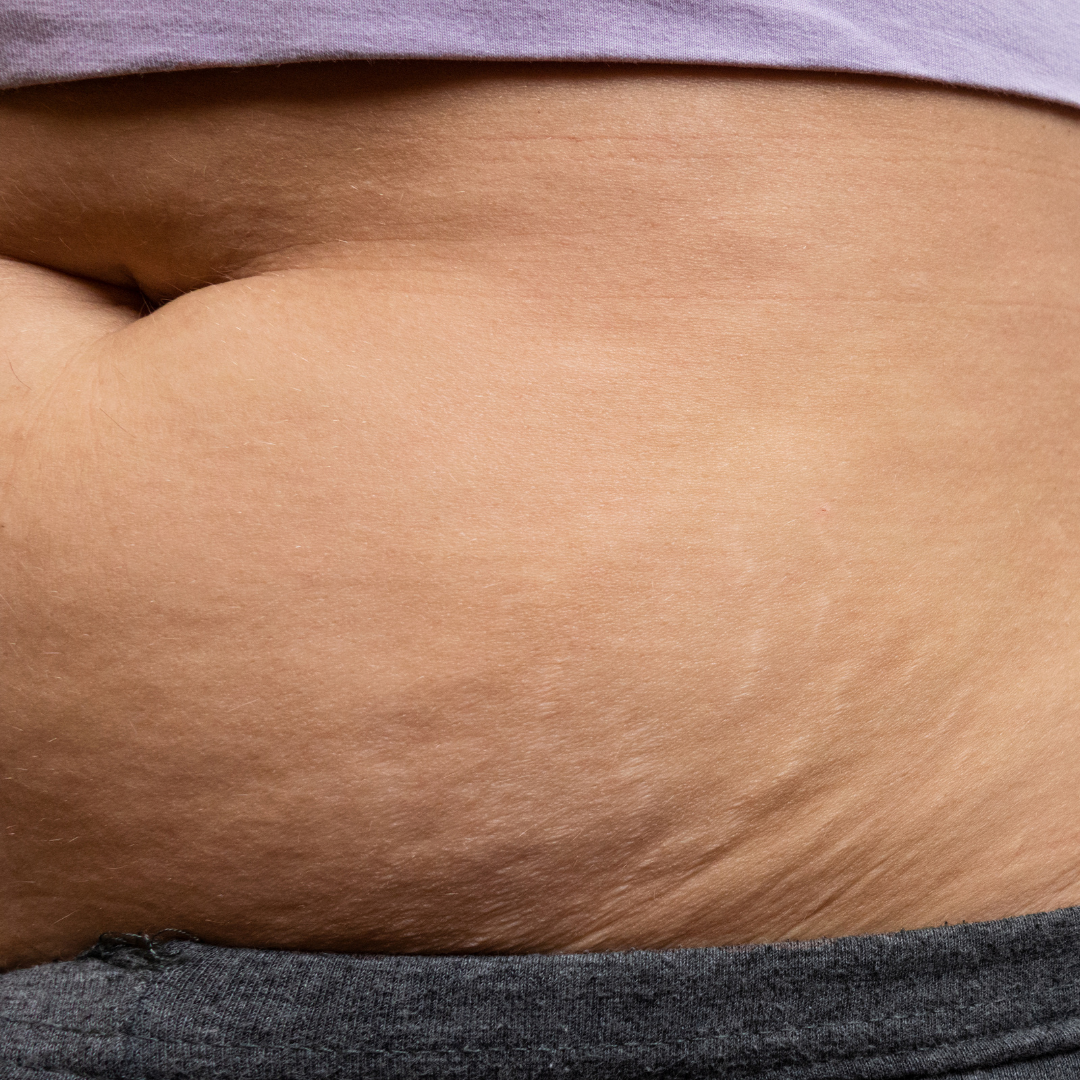 beneficios de usar faja postparto
