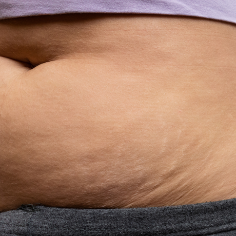 beneficios de usar faja postparto